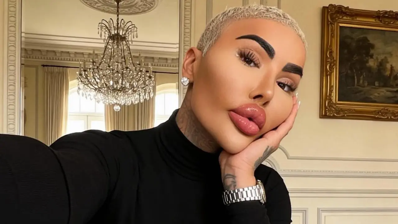 Influencer con múltiples cirugías estéticas en Londres, símbolo de los riesgos mortales de procedimientos como el BBL