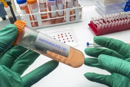 Científicos analizan muestras en laboratorio con la primera prueba PCR capaz de detectar hantavirus en fase inicial