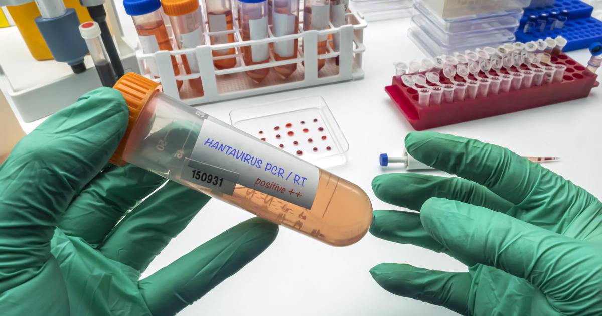 Científicos analizan muestras en laboratorio con la primera prueba PCR capaz de detectar hantavirus en fase inicial